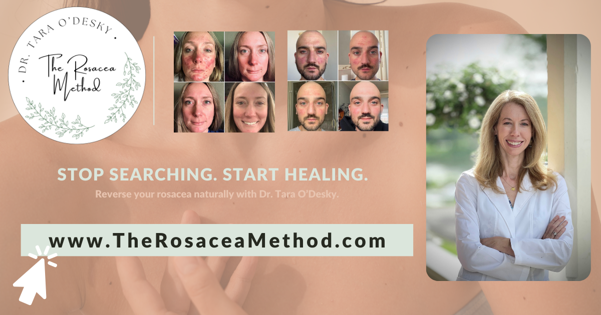 Holistic Rosacea Remission Treatment Program: Transform Your Skin Naturally