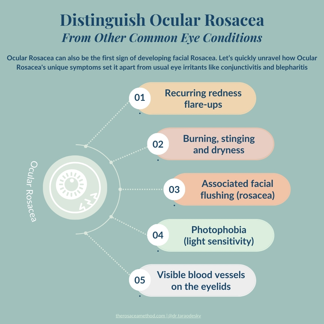 Infographic presenting how to treat ocular rosacea and differentiate it from common eye conditions, with a list of unique symptoms such as recurring redness flare-ups, burning, stinging and dryness, associated facial flushing, photophobia, and visible blood vessels on the eyelids.