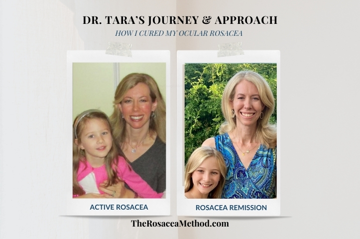 My (Dr. Tara) before and after showing how I cured my ocular rosacea naturally, highlighting clear skin improvement next to my daughter—from active rosacea symptoms in 2019 to rosacea remission in 2022.